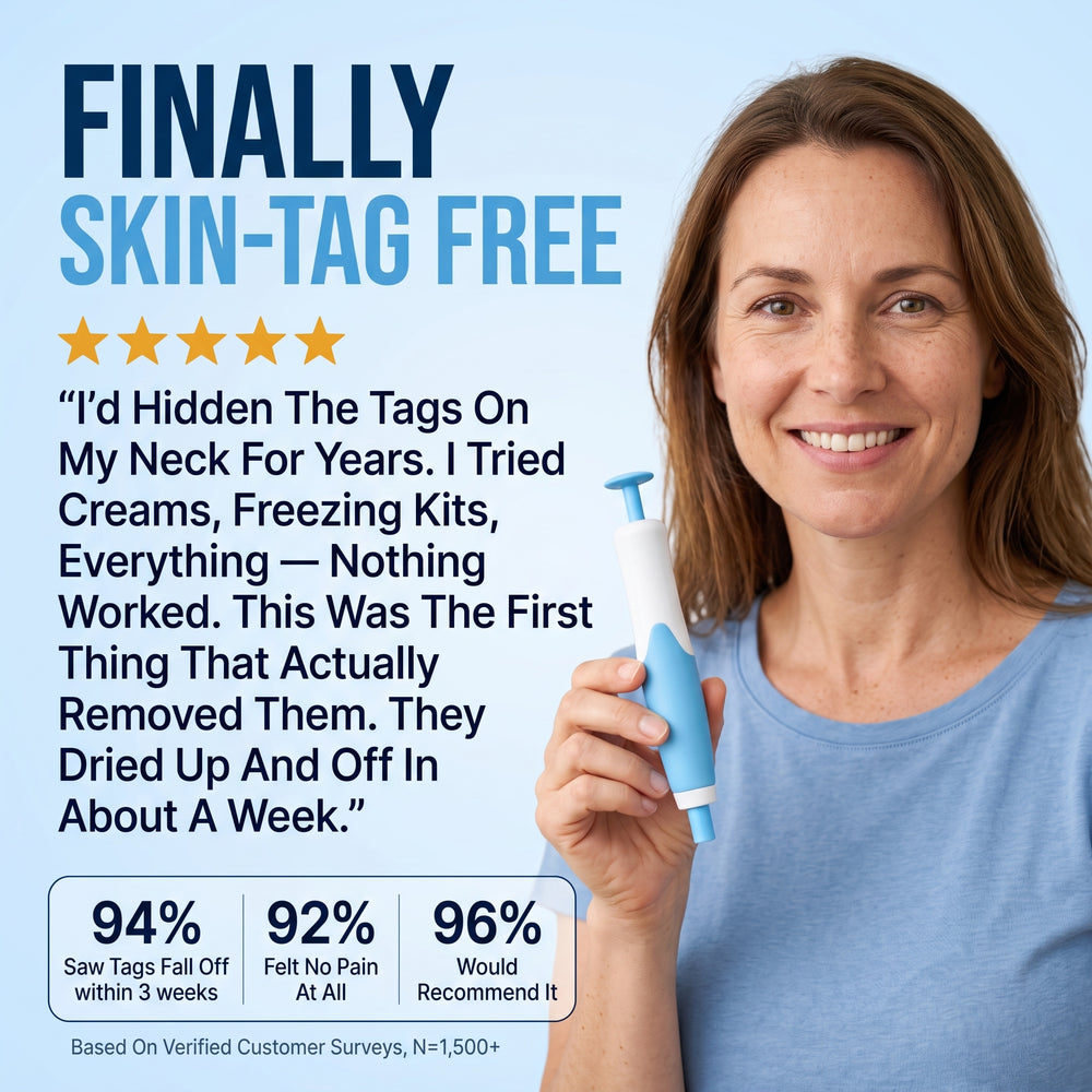 Sidekck Skin Tag Remover Kit